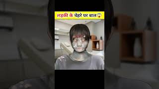 OMG?लड़की के चेहरे पर infection ?( 3D Animation ) shorts ytshorts youtubeshorts