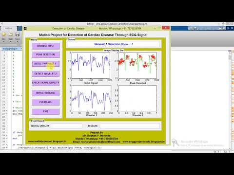 Matlab Project for Detection of Cardiac Disease from ECG Signal Data Source Code || IEEE Project