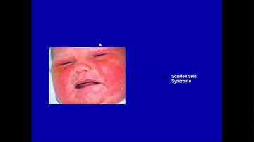 Gram Positive Cocci Part 1 Staph