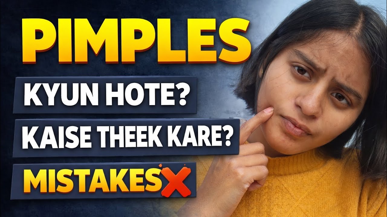 Pimples Kyun Hote Hain? | Causes, Cure & Mistakes.