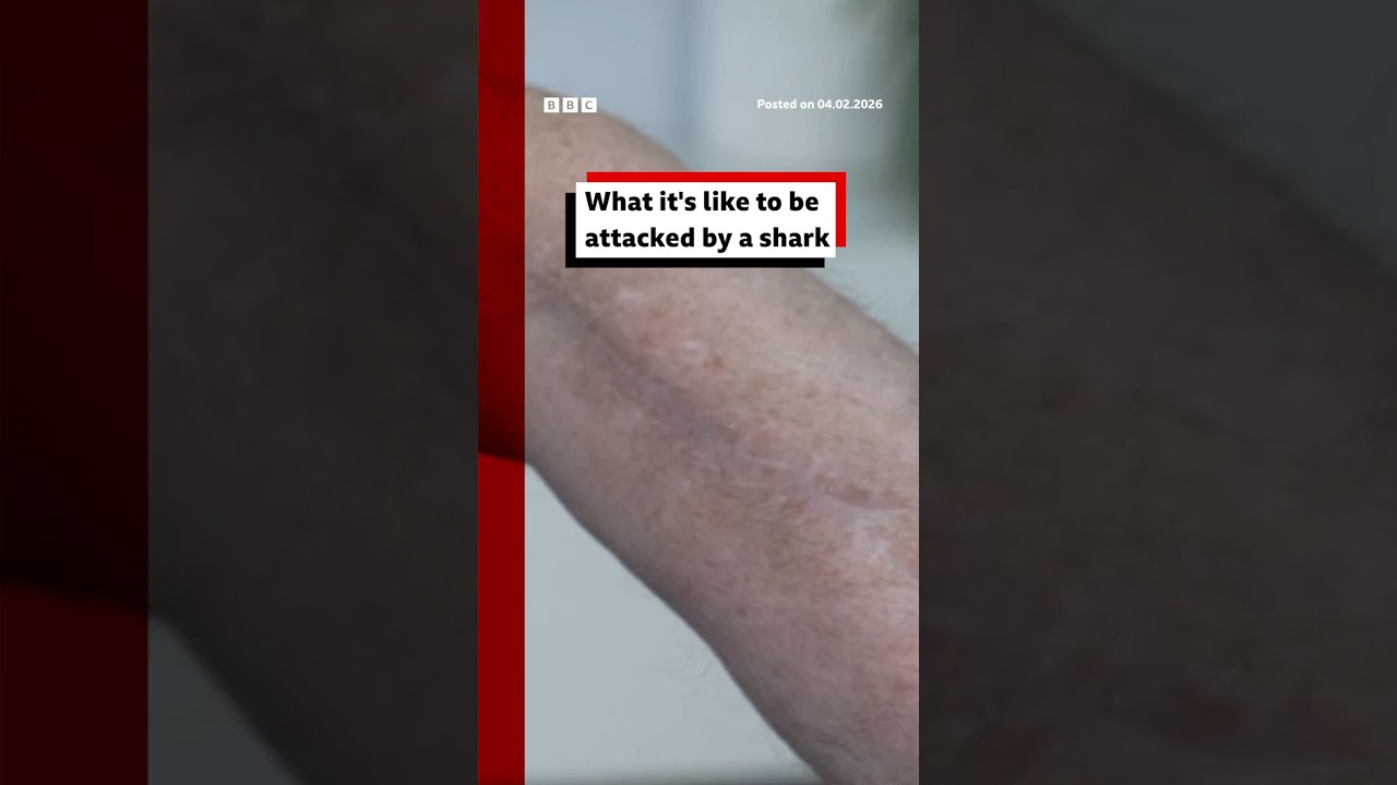 What it's like to be attacked by a shark. #Sharks #SharkAttack #BBCNews