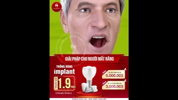 Trồng Răng Implant - Giải Pháp Khôi Phục Răng Mất Hoàn Hảo