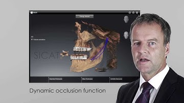 SICAT Implant - Implanting more successfully with SICAT surgical guides