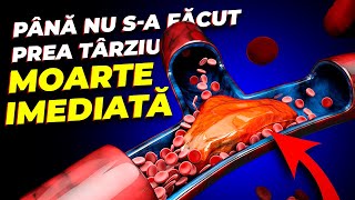 Cum să-ți Dizolvi rapid Trombozele la tine Acasă? Și cum să Previi apariția Lor...