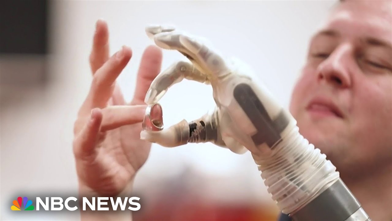 An AI-powered chip allows an amputee to control his robot prosthetic with his mind An AI-powered chip allows an amputee to control his robot prosthetic with his mind