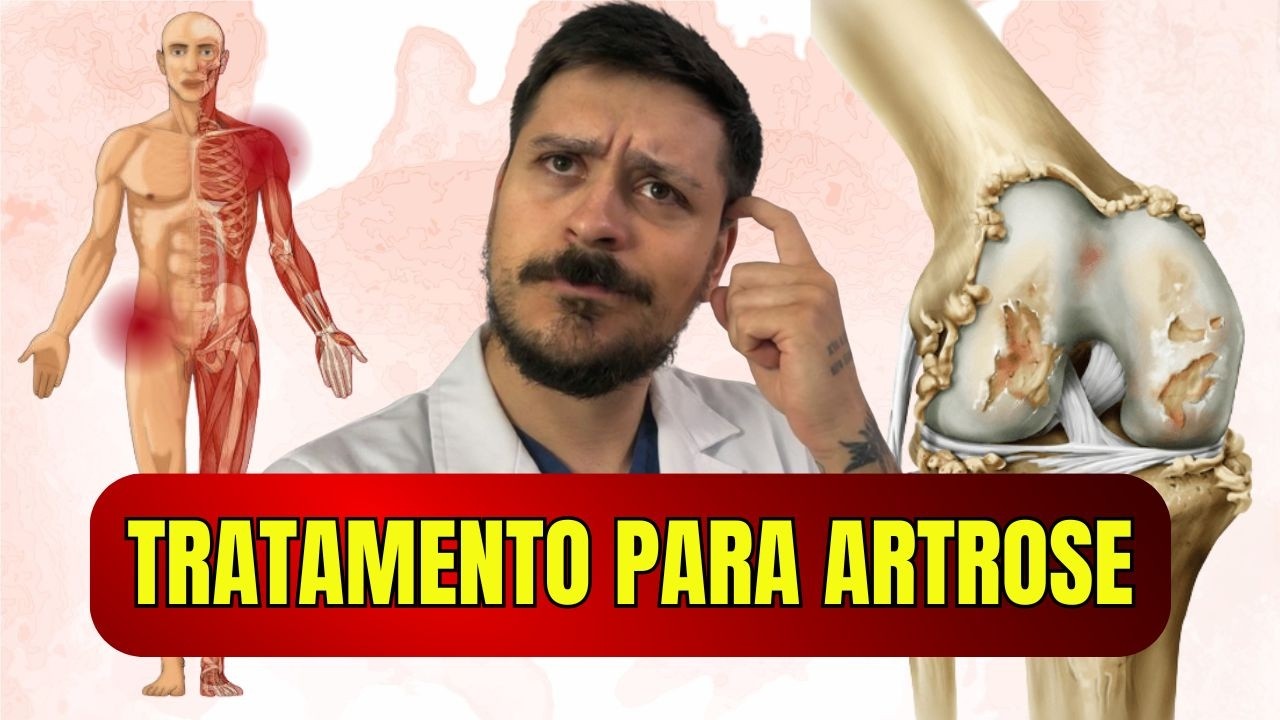COMO TRATAR A ARTROSE? Exercícios para alívio da dor e tratamento