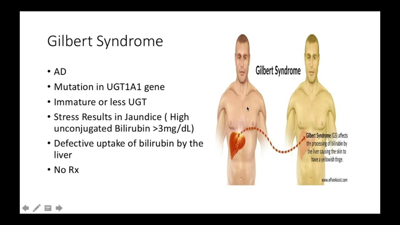 Crigler Nijjar, Gilbert, Dubin Johnson, Rotor Syndrome YouTube