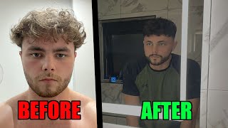 5 Expert Looksmaxxing Tips To Transform Your Appearance | Self Improvement Guide