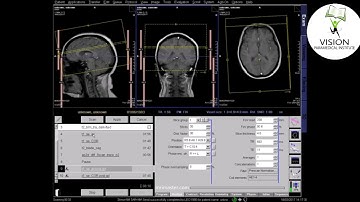 MRI Brain With Contrast ( Siemens Technique)