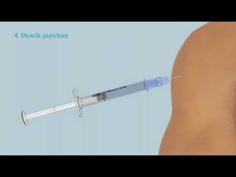 SKIFA Auto Disable/Destruct Syringe with Needle 0.5 ml - YouTube