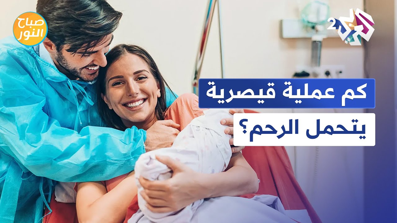 كم مرة تستطيع المرأة ان تنجب بالولادة القيصرية؟