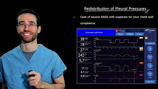 Week 29: ARDS - Proning and Putting Everything Together