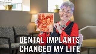 Download Lagu My health improved when my fillings were replaced MP3