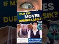 Bladeless flapless Smartsurf LASIK in Jalandhar Safety & Precision”