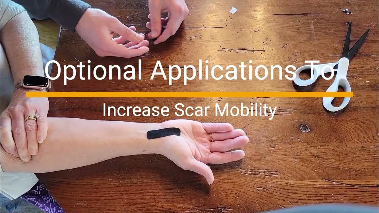 Taping Technique For Scars YouTube