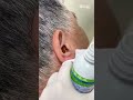 耳の中から虫が出てくる