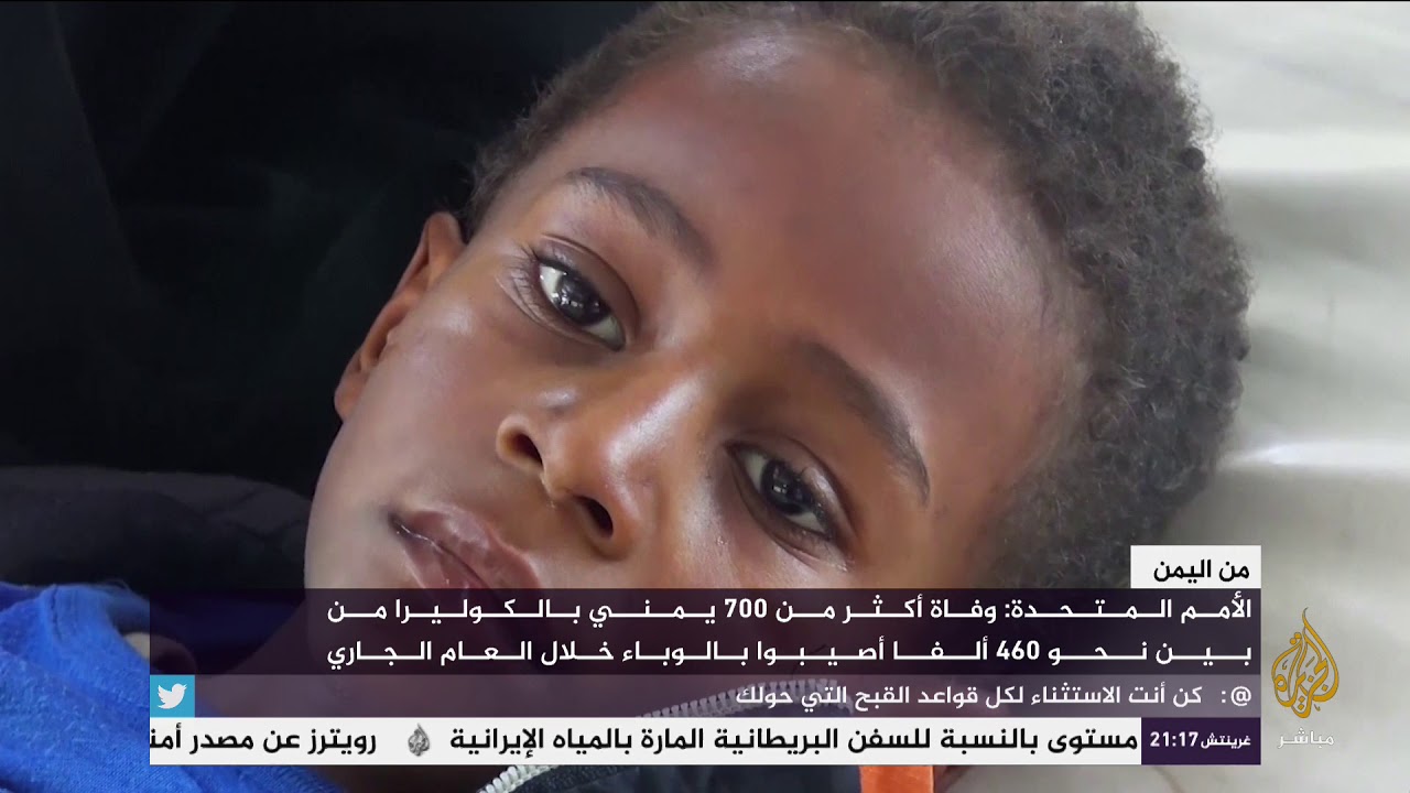 وفاة طفل يبلغ من العمر 7 سنوات في أحد مستشفيات صنعاء بسبب الكوليرا