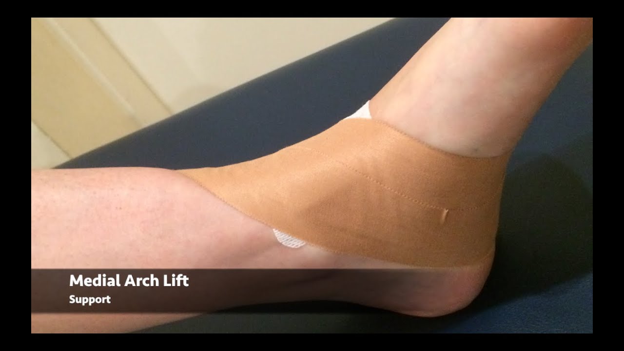 How to tape the foot - medial arch pain 