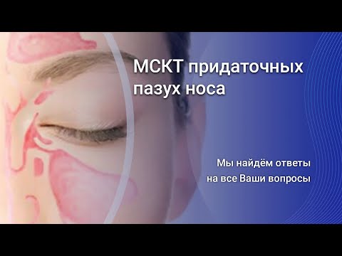 МСКТ придаточных пазух носа