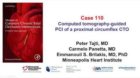 Case 110: Manual of CTO Interventions - CT angiography for guiding ostial circumflex CTO PCI