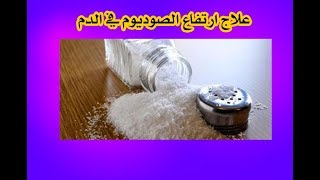 علاج ارتفاع الصوديوم في الدم