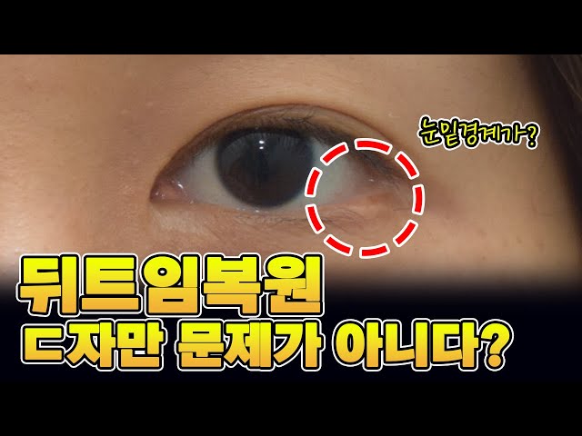 ㄷ자변형만 뒤트임복원 대상이 아닙니다