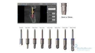 Bio | Max Fully Guided Keyless Surgical Kit