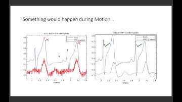 Robust Algorithms for Non-invasive Blood Pressure Estimation from Wearable Sensors [HD]