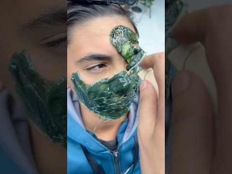 ازالة الشعر المتسلطن من الوجه       