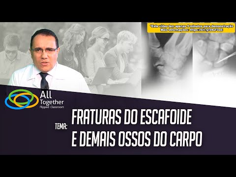 Vídeo: O escafoide é um osso do carpo?