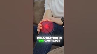 The No. 1 Vitamin for Arthrytis⚡️#health #shorts