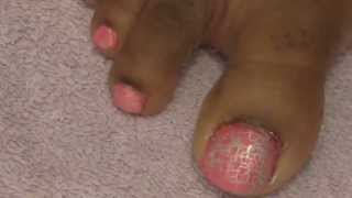 Neon Pink Toe Nail Design