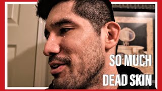 Exfoliating Skin Care And Burning Face 4K Hd
