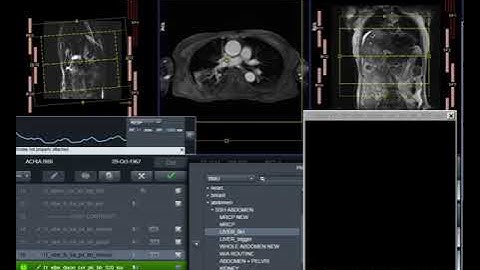 MRI of Liver Planning Step by Step | Siemens 1.5T & 3T Protocol