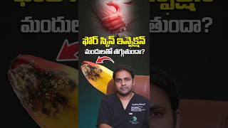 ఫోర్ స్కిన్ ఇన్ఫెక్షన్ మందులతో తగ్గుతుందా? | Stapler Circumcision for Phimosis | Dr KSR | #shorts