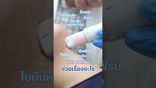 Volnewmer มนเวอรยงไง มาดกน