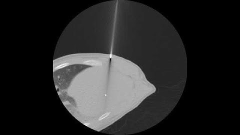 CT image during needle puncture into the swine liver with Zerobot@