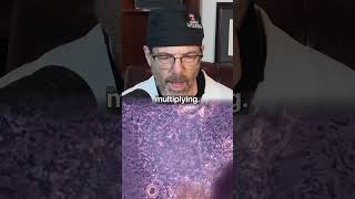 Millions of Bacteria vs Alcohol  🦠 Surgeon Reacts