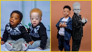 Unusual Black Twins Born of Same Parent But With Different Colors
