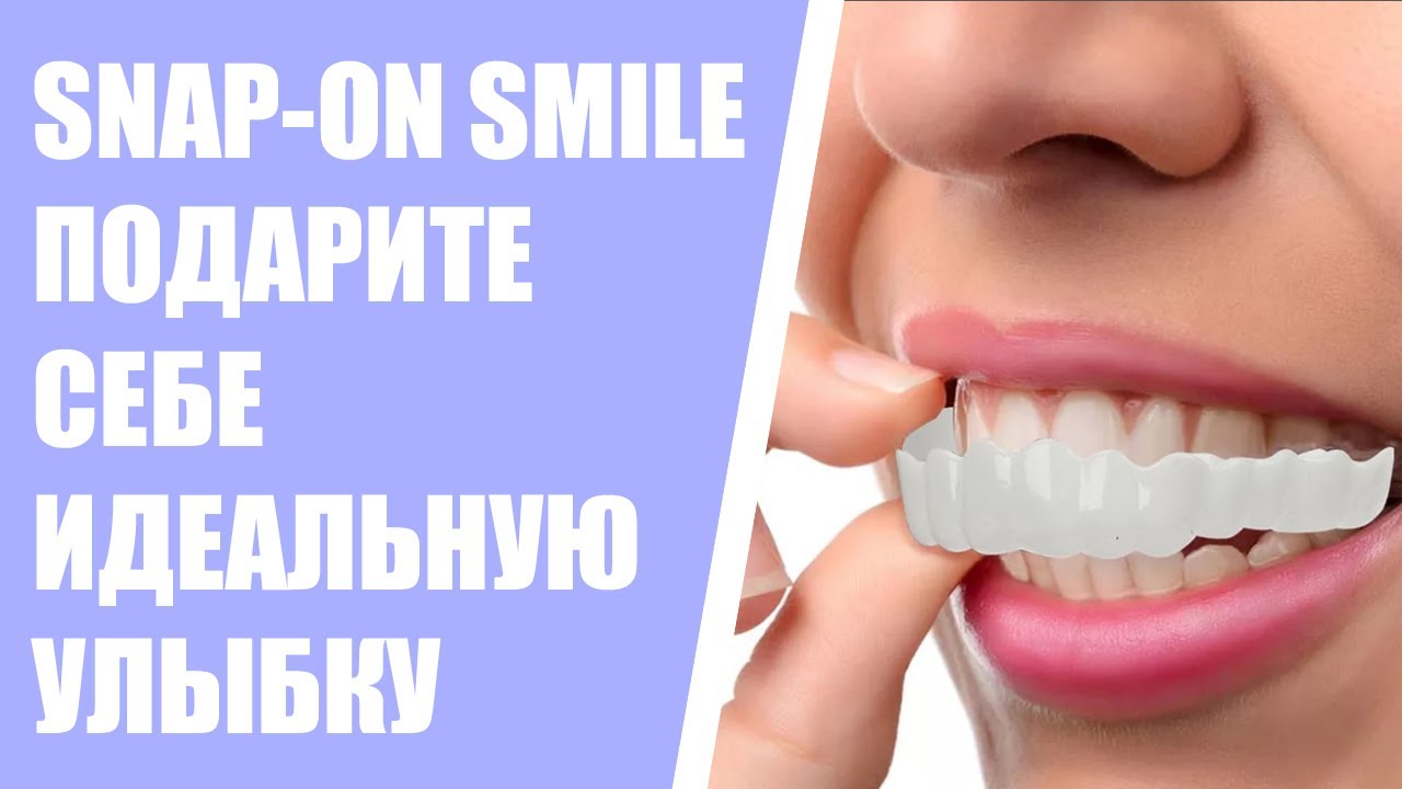 😀 Можно ли поставить виниры если нет зубов ⚪ Сколько стоят виниры на зубы в тольятти