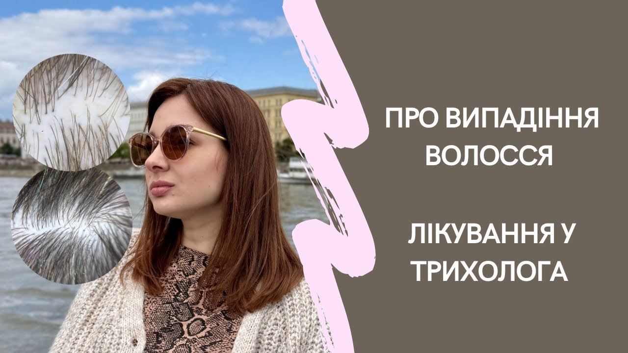 Про випадіння волосся, моя історія. Алопеція і лікування у трихолога. Огляд тоніку weleda