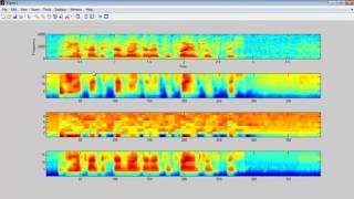 Speaker’s age gender classification matlab projects Wealth