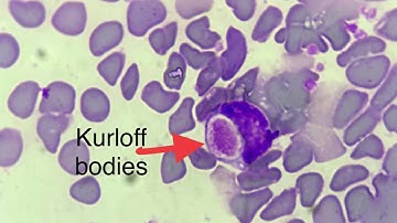 Foa-kurloff cells in Guinea pig blood smear