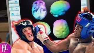 Logan Paul Reveals Brain Damage & Told Not To Fight KSI | Hollywoodlife