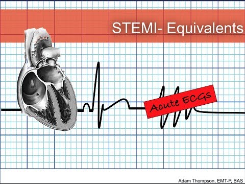 stemi-equivalents