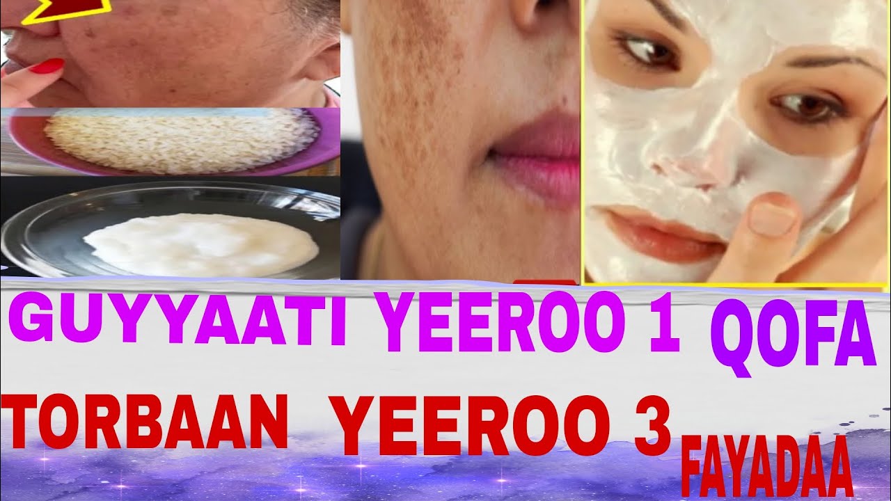GUYYAATI YEEROO 1 TORBAANIT YEEROO 3 QOFA FAYADAMA