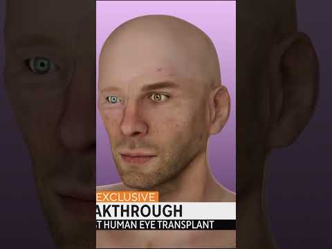 أول عملية زراعة عين في العالم 