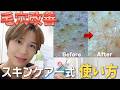 【忖度なし】毛穴改善に特化したスキンケア一式の使い方＆レビュー！