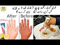 Mix turmeric in toothpaste and you will be surprised by the results