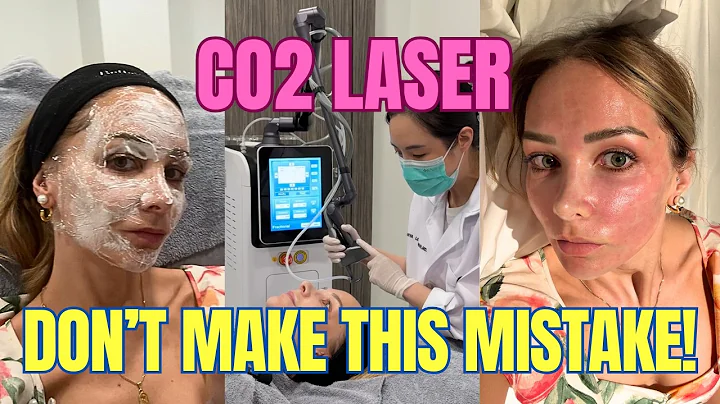 Everything you need to know BEFORE getting CO2 laser treatment 2025 | before & after | honest review